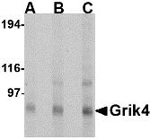 Western blot of Grik4 in Rat brain tissue lysate with Grik4 antibody at (A) 0.5, (B) 1 and (C) 2 ug/ml.