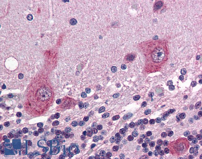 Anti-GRIK5 antibody IHC of human brain, cerebellum. Immunohistochemistry of formalin-fixed, paraffin-embedded tissue after heat-induced antigen retrieval. Antibody LS-B2702 concentration 5 ug/ml.