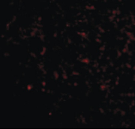 Immunofluorescence of Grik5 in Human Brain cells with Grik5 antibody at 20 ug/ml.