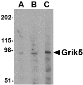 Western blot of Grik5 in human brain tissue lysate with Grik5 antibody at (A) 0.5, (B) 1 and (C) 2 ug/ml.