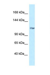 GRIK5 antibody LS-C145759 Western blot of Mouse Pancreas lysate. Antibody concentration 1 ug/ml.