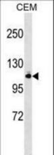GRIK5 Antibody western blot of CEM cell line lysates (35 ug/lane). The GRIK5 antibody detected the GRIK5 protein (arrow).