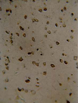 IHC: Paraffin embedded rat brain stained with anti-KA2 at 5 mcg/ml (20X magnification)