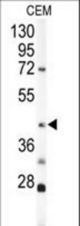 Western blot of KRT19 Antibody in CEM cell line lysates (35 ug/lane). KRT19 (arrow) was detected using the purified antibody.