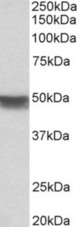 KRT20 antibody (0.03 ug/ml) staining of Human Colon lysate (35 ug protein in RIPA buffer). Primary incubation was 1 hour. Detected by chemiluminescence.
