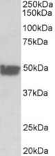 KRT20 antibody (0.03 ug/ml) staining of Human Colon lysate (35 ug protein in RIPA buffer). Primary incubation was 1 hour. Detected by chemiluminescence.