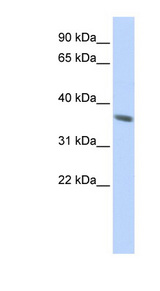 KRT222 / KRT222P antibody LS-C102491 Western blot of Jurkat lysate.