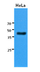 Western Blot: The cell lysates of HeLa (30 ug) were resolved by SDS-PAGE, transferred to PVDF membrane and probed with anti-human KRT23 antibody (1:3000). Proteins were visualized using a goat anti-mouse secondary antibody conjugated to HRP and an ECL detection system.