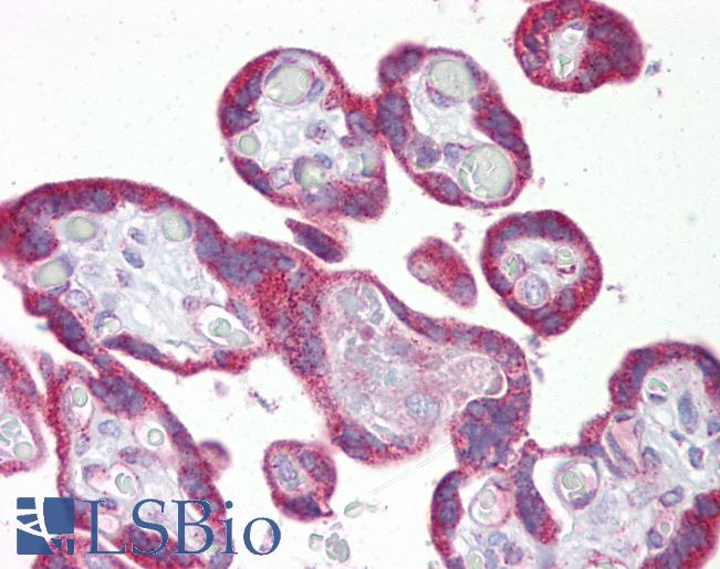 Anti-KRT23 / Cytokeratin 23 antibody IHC of human placenta. Immunohistochemistry of formalin-fixed, paraffin-embedded tissue after heat-induced antigen retrieval. Antibody LS-B6631 concentration 5 ug/ml.