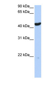 KRT23 / Cytokeratin 23 antibody LS-B6631 Western blot of 721_B cell lysate.