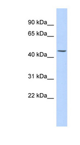 KRT24 / Cytokeratin 24 antibody LS-C102424 Western blot of Fetal Kidney lysate.