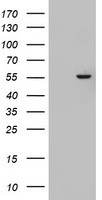 HEK293T cells were transfected with the pCMV6-ENTRY control (Left lane) or pCMV6-ENTRY KRT24 (Right lane) cDNA for 48 hrs and lysed. Equivalent amounts of cell lysates (5 ug per lane) were separated by SDS-PAGE and immunoblotted with anti-KRT24.