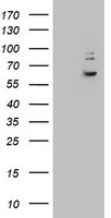 HEK293T cells were transfected with the pCMV6-ENTRY control (Left lane) or pCMV6-ENTRY KRT24 (Right lane) cDNA for 48 hrs and lysed. Equivalent amounts of cell lysates (5 ug per lane) were separated by SDS-PAGE and immunoblotted with anti-KRT24.