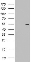 HEK293T cells were transfected with the pCMV6-ENTRY control (Left lane) or pCMV6-ENTRY KRT24 (Right lane) cDNA for 48 hrs and lysed. Equivalent amounts of cell lysates (5 ug per lane) were separated by SDS-PAGE and immunoblotted with anti-KRT24.