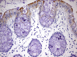 IHC of paraffin-embedded Human colon tissue using anti-KRT24 mouse monoclonal antibody. (Heat-induced epitope retrieval by 10mM citric buffer, pH6.0, 120°C for 3min).