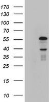 HEK293T cells were transfected with the pCMV6-ENTRY control (Left lane) or pCMV6-ENTRY KRT24 (Right lane) cDNA for 48 hrs and lysed. Equivalent amounts of cell lysates (5 ug per lane) were separated by SDS-PAGE and immunoblotted with anti-KRT24.