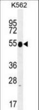 KRT25 Antibody western blot of K562 cell line lysates (35 ug/lane). The KRT25 antibody detected the KRT25 protein (arrow).