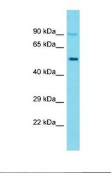 Western blot of Human PANC1. KRT26 antibody dilution 1.0 ug/ml.