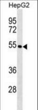 KRT26 Antibody western blot of HepG2 cell line lysates (35 ug/lane). The KRT26 antibody detected the KRT26 protein (arrow).