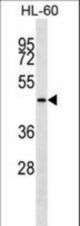 KRT28 Antibody western blot of HL-60 cell line lysates (35 ug/lane). The KRT28 antibody detected the KRT28 protein (arrow).