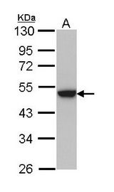 Sample (30 ug of whole cell lysate). A: Hela. 10% SDS PAGE. KRT31 / HHA1 antibody diluted at 1:1000.
