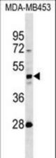 KRT31 Antibody western blot of MDA-MB453 cell line lysates (35 ug/lane). The KRT31 antibody detected the KRT31 protein (arrow).