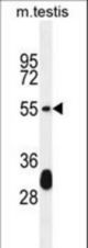 KT33A Antibody western blot of mouse testis tissue lysates (35 ug/lane). The KT33A antibody detected the KT33A protein (arrow).