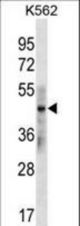 KRT33B Antibody western blot of K562 cell line lysates (35 ug/lane). The KRT33B antibody detected the KRT33B protein (arrow).