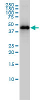 KRTHA3B monoclonal antibody (M01), clone 4A6-A7 Western Blot analysis of KRTHA3B expression in MCF-7.