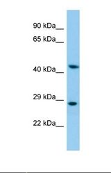 Western blot of Human HepG2. KRT35 antibody dilution 1.0 ug/ml.
