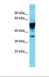 Western blot of Rat Lung. Krt35 antibody dilution 1.0 ug/ml.