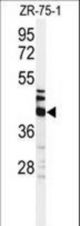 Western blot of KRT35 Antibody in ZR-75-1 cell line lysates (35 ug/lane). KRT35 (arrow) was detected using the purified antibody.