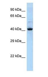 KRT36 / Cytokeratin 36 antibody Western Blot of NCI-H226. Antibody dilution: 1 ug/ml.