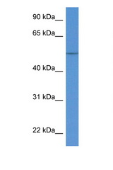 KRT36 / Cytokeratin 36 antibody LS-C135942 Western blot of Fetal Kidney lysate. Antibody concentration 1 ug/ml.