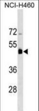 KRT36 Antibody western blot of NCI-H460 cell line lysates (35 ug/lane). The KRT36 antibody detected the KRT36 protein (arrow).