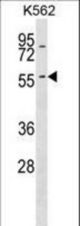 KRT6A Antibody western blot of K562 cell line lysates (35 ug/lane). The KRT6A antibody detected the KRT6A protein (arrow).