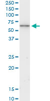 KRT6B monoclonal antibody (M01), clone 4G9. Western Blot analysis of KRT6B expression in A-431.