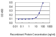 Detection limit for recombinant GST tagged KRT6B is 3 ng/ml as a capture antibody.
