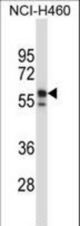 KRT6B Antibody western blot of NCI-H460 cell line lysates (35 ug/lane). The KRT6B antibody detected the KRT6B protein (arrow).