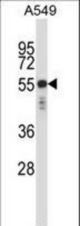 KRT6C Antibody western blot of A549 cell line lysates (35 ug/lane). The KRT6C antibody detected the KRT6C protein (arrow).