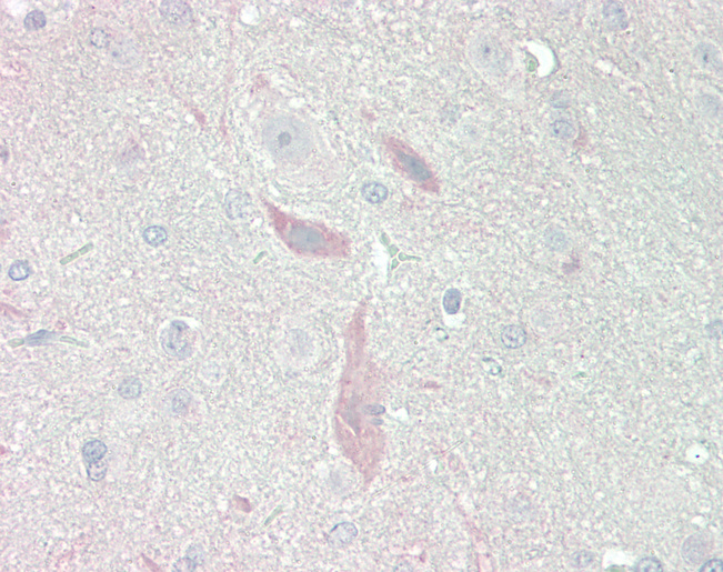 Rat Brain: Formalin-Fixed, Paraffin-Embedded (FFPE)
