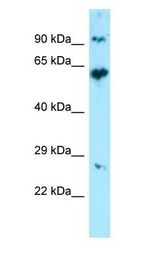 KRT71 antibody Western Blot of 293T.