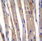 KRT73 Antibody immunohistochemistry of formalin-fixed and paraffin-embedded m.heart tissue followed by peroxidase-conjugated secondary antibody and DAB staining.