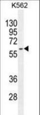 KRT73 Antibody western blot of K562 cell line lysates (35 ug/lane). The KRT73 antibody detected the KRT73 protein (arrow).