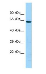 KRT74 antibody Western Blot of 721_B.