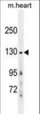 GRIN2A Antibody western blot of mouse heart tissue lysates (35 ug/lane). The GRIN2A antibody detected the GRIN2A protein (arrow).