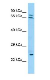 KRT74 antibody Western Blot of Jurkat.