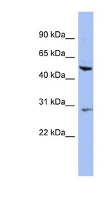 KRT75 antibody LS-C112252 Western blot of HT1080 cell lysate.
