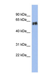 KRT75 antibody LS-C112253 Western blot of Fetal Small Intestine lysate.