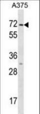KRT75 Antibody western blot of A375 cell line lysates (35 ug/lane). The KRT75 antibody detected the KRT75 protein (arrow).